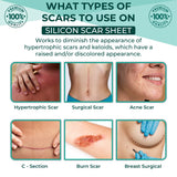 Silicone Scar Sheets for C-Sections Scar Solution 4 Sheets