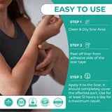 Silicone Scar Sheets for C-Sections Scar Solution 4 Sheets